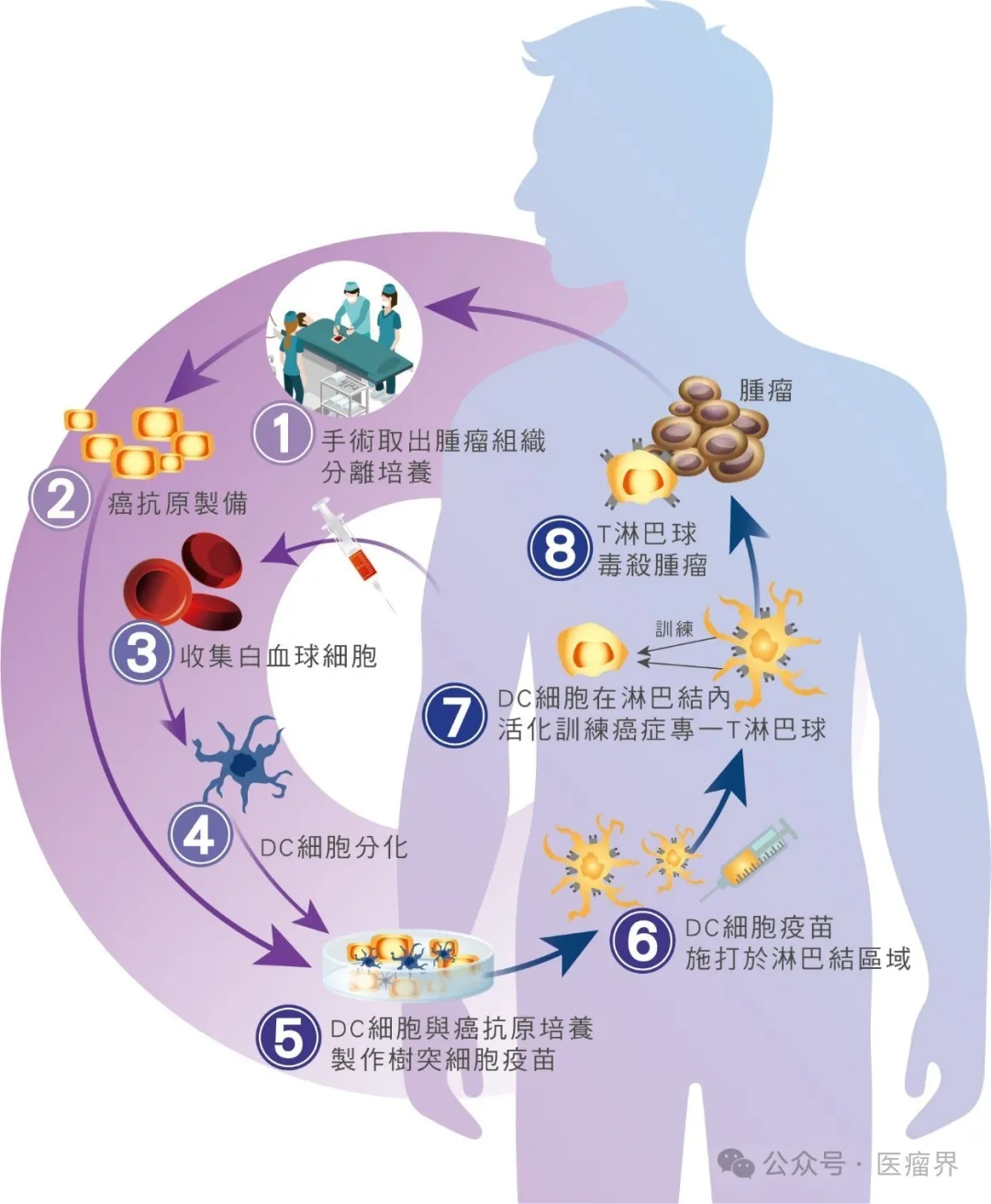 详细了解DC疫苗