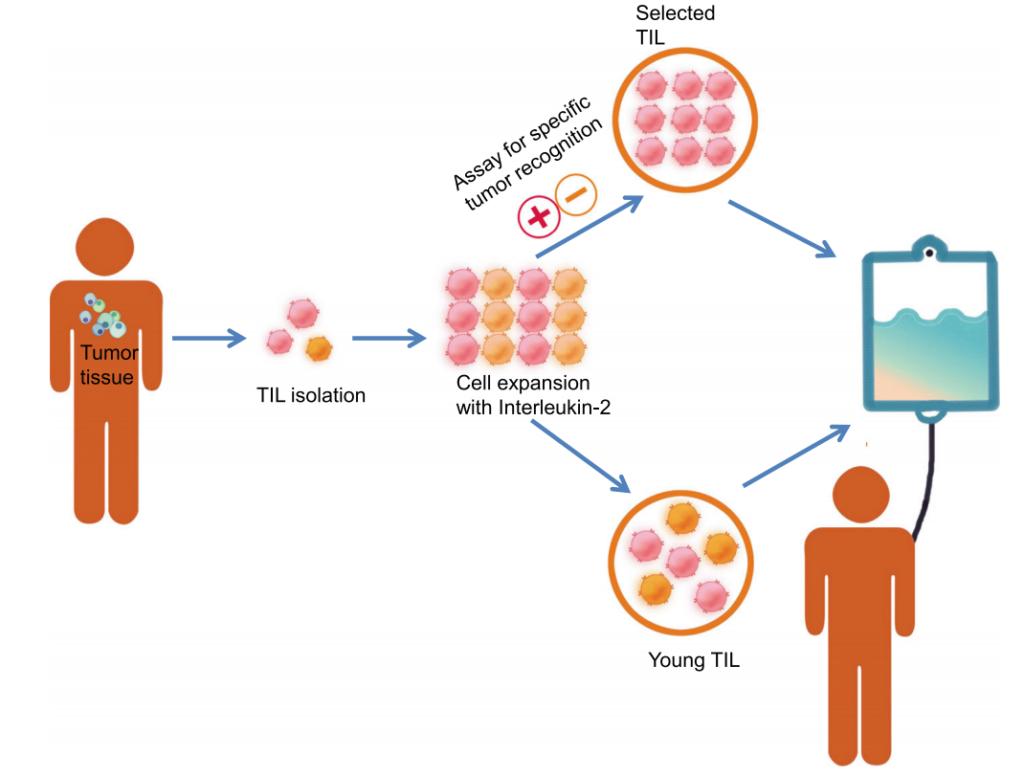 借助TIL细胞存活超10年！国内TIL细胞在卵巢癌、宫颈癌、肺癌、骨肉瘤等实体瘤中大展身手