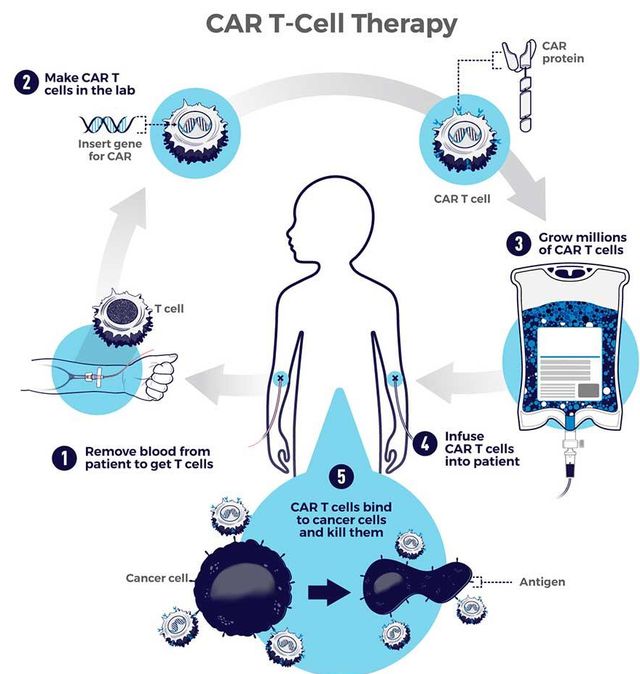 CAR-T细胞疗法重击结直肠癌、甲状腺癌、卵巢癌等实体瘤